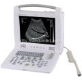 Portable Ultrasound Scanner Laptop Portable Ultrasound Harga Mesin